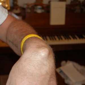 Bump na ruku na zglob, ili higroma: simptomi, uzroci i tretmani
