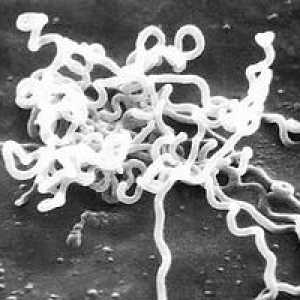 Spiroheta pale. Uzročnik sifilisa - Treponema blijedo