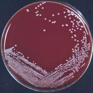 Staphylococcus epidermidis (Staphylococcus epidermidis) - simptomi, uzroci, liječenje. Koji god je…
