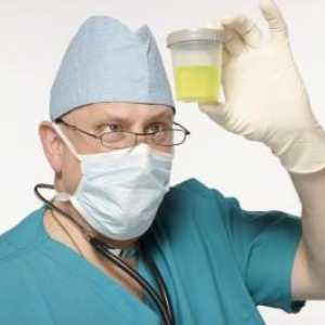 Dnevna proizvodnja urina, ili kako da se prikupe dnevni urin