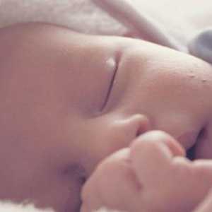 Toksični eritem novorođenčadi: uzroci, liječenje