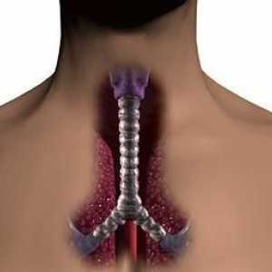 Traheitise: simptomi akutne i hronične upale dušnika