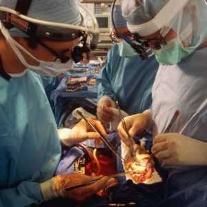 Transplantacija organa i tkiva. Transplantacija organa u Rusiji