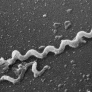 Treponema pallidum (Treponema pallidum) - uzročnika sifilisa