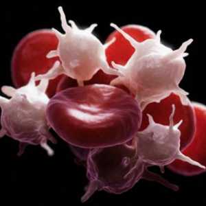 Trombociti: norma kod djece. Analiza krvnih pločica: dešifrovanje i tumačenje rezultata
