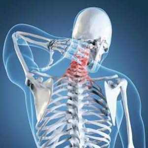 Unkovertebralny osteoartritis vratne kralježnice: uzroci i liječenje