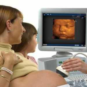 3D ultrazvuk u trudnoći
