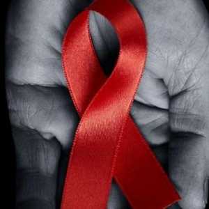 HIV infekcija se prenosi i kod kuće? Načinima prenošenja HIV infekcije