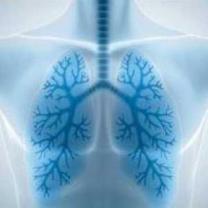 Pneumonije: Simptomi (bez temperature). Koji su simptomi upale pluća