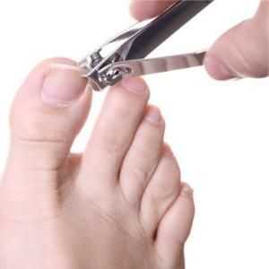 Urasta nokte: uzroci i tretmani