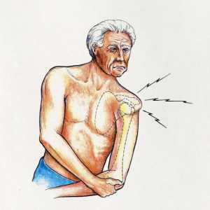 Dislokacija ramenog zgloba: tretman kod kuće. Dislokacija ramenog zgloba: uzroci