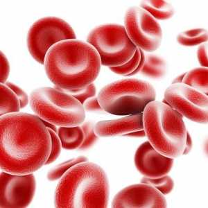 Iron anemije: Simptomi, tretman, prevencija