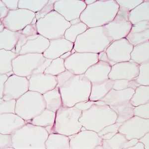 Masnog tkiva i njegove vrste